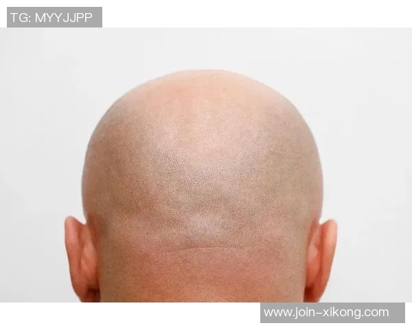 美记建议布朗剃光头更省心发际线粉不如简单直接